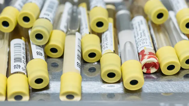 Tubos para muestras clínicas