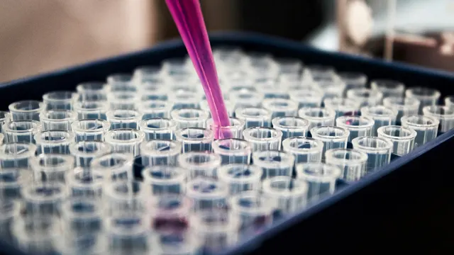 Micropipeta depositando muestra en tubos