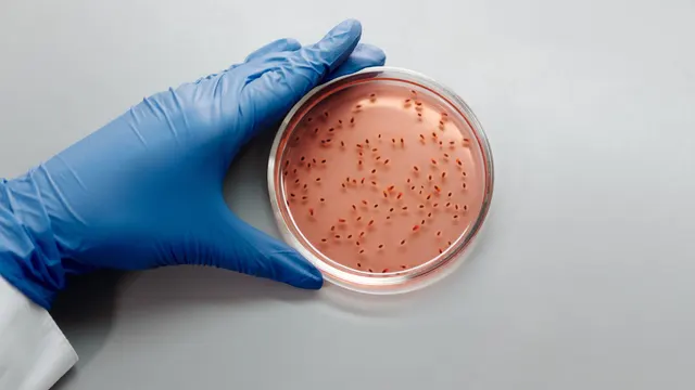 Caja Petri con colonias bacterianas